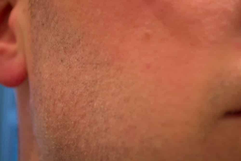 cheek close up after shaving with a dorco prime double edge safety razor - tools of men