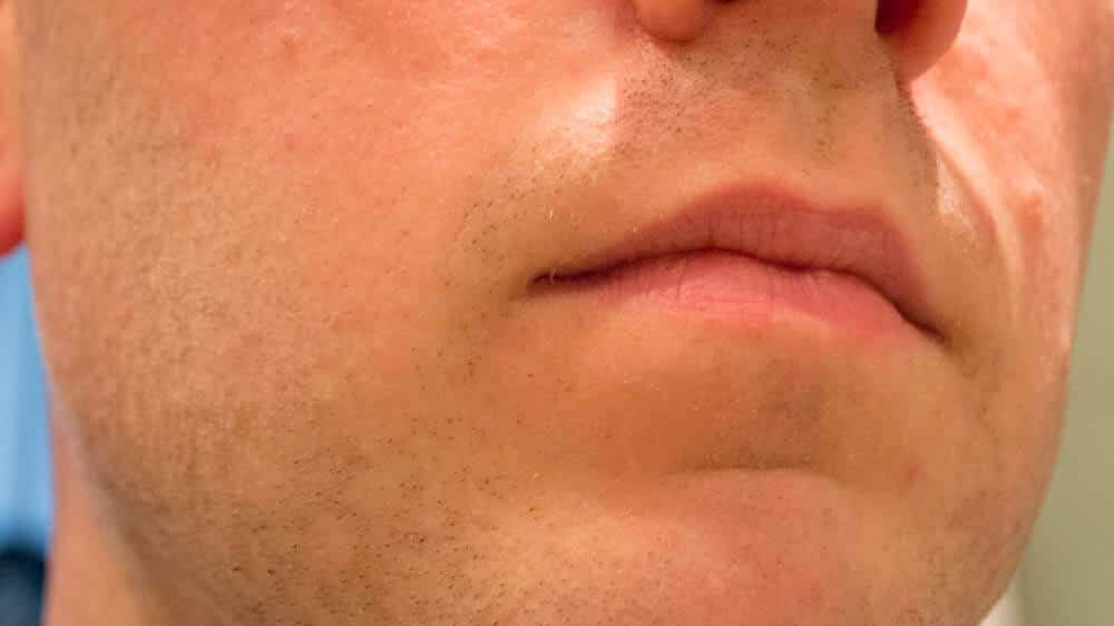 whole face overview of the dorco prime safety razor - tools of men