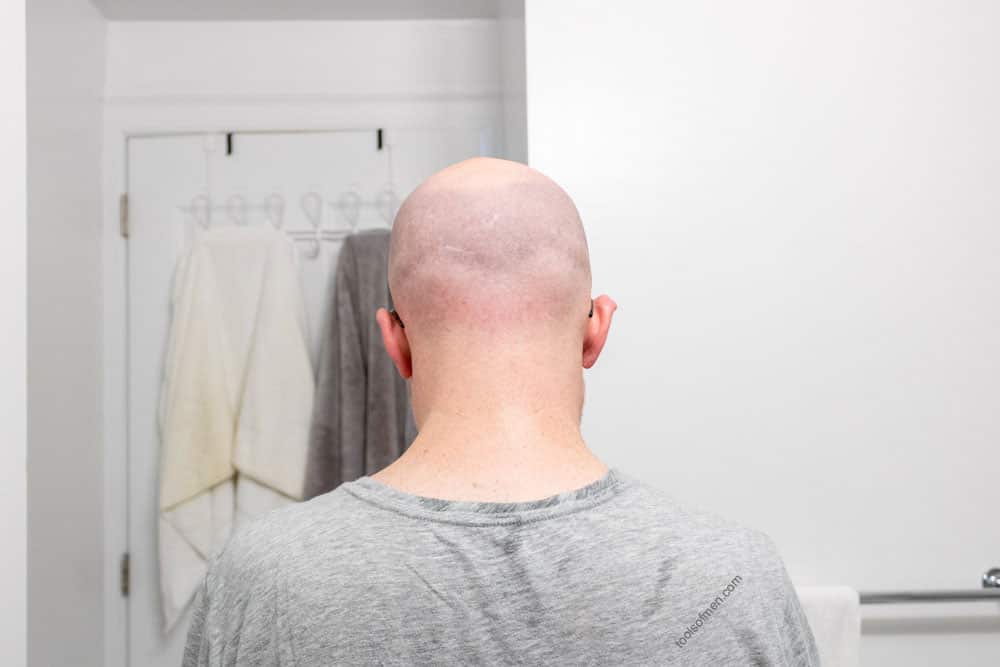 back of mans head after using headblade moto