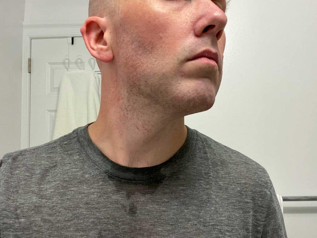 closeup view of neck and cheek after shaving