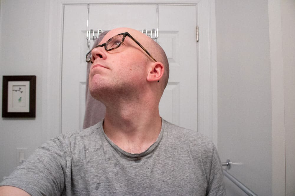 man showing neck to demonstrate results of the merkur 34c