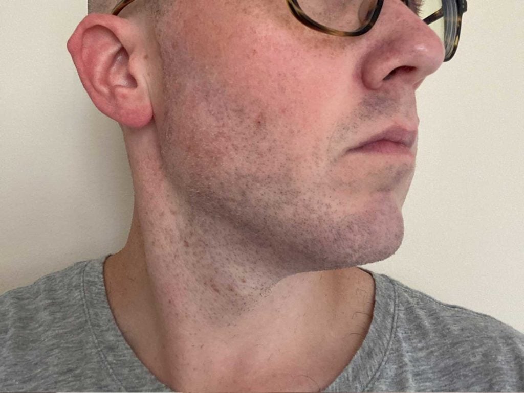 closeup of mans face after using the oneblade core