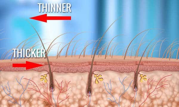 thicker thinner hair follicle