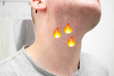 14 Ways to Prevent Razor Burn on Your Neck (and Elsewhere)