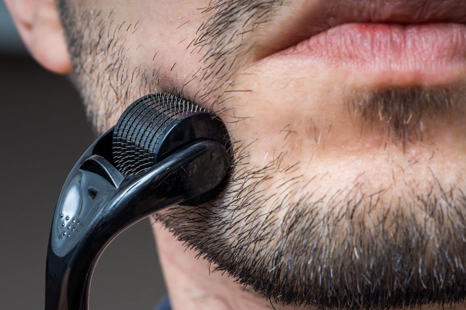 Derma Roller for Beard Growth