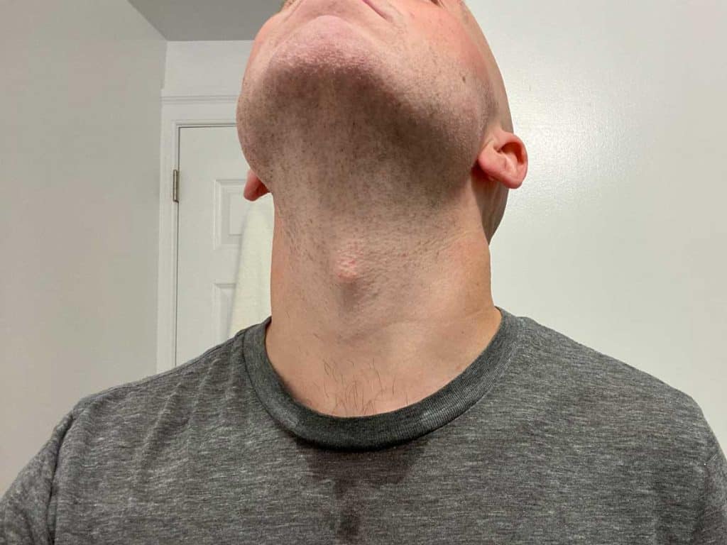 alternate view of face after shaving