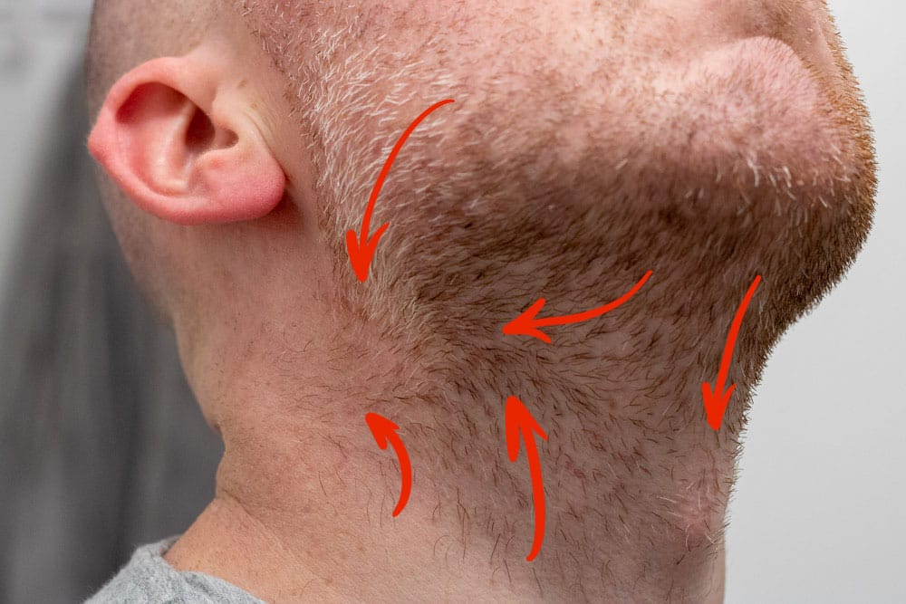 another side view of neck of man with red arrows indicating hair growth direction