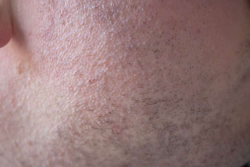 closeup of cheek after shaving with the trimmer