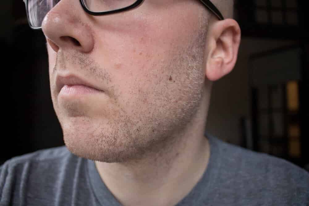 closeup of face before shaving