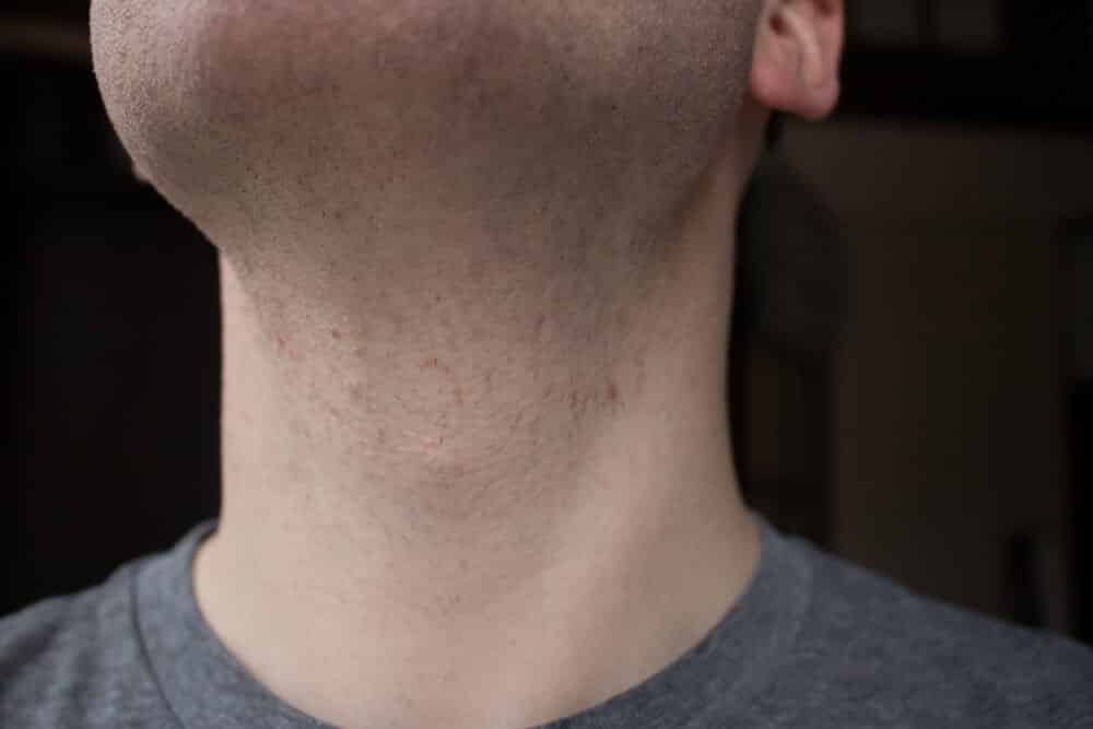 closeup of neck after shaving