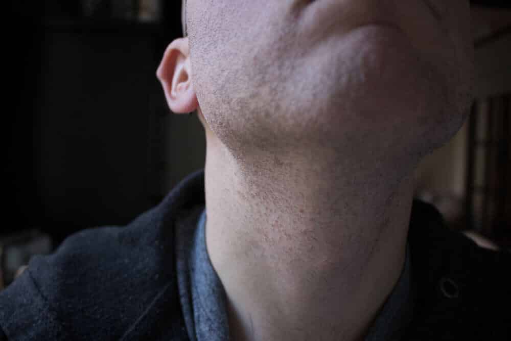 closeup of the neck area