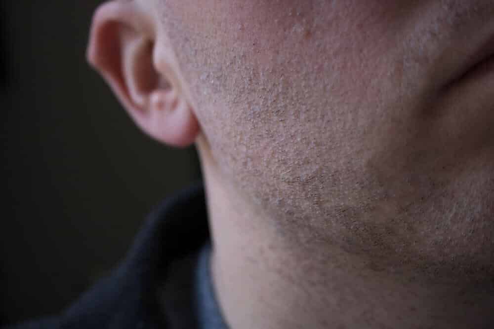 closeup of the skin after using the oneblade trimmer