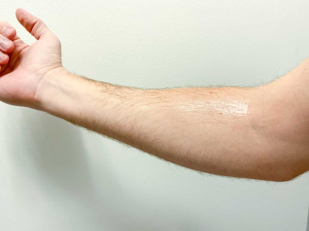 forearm with huron face cream applied