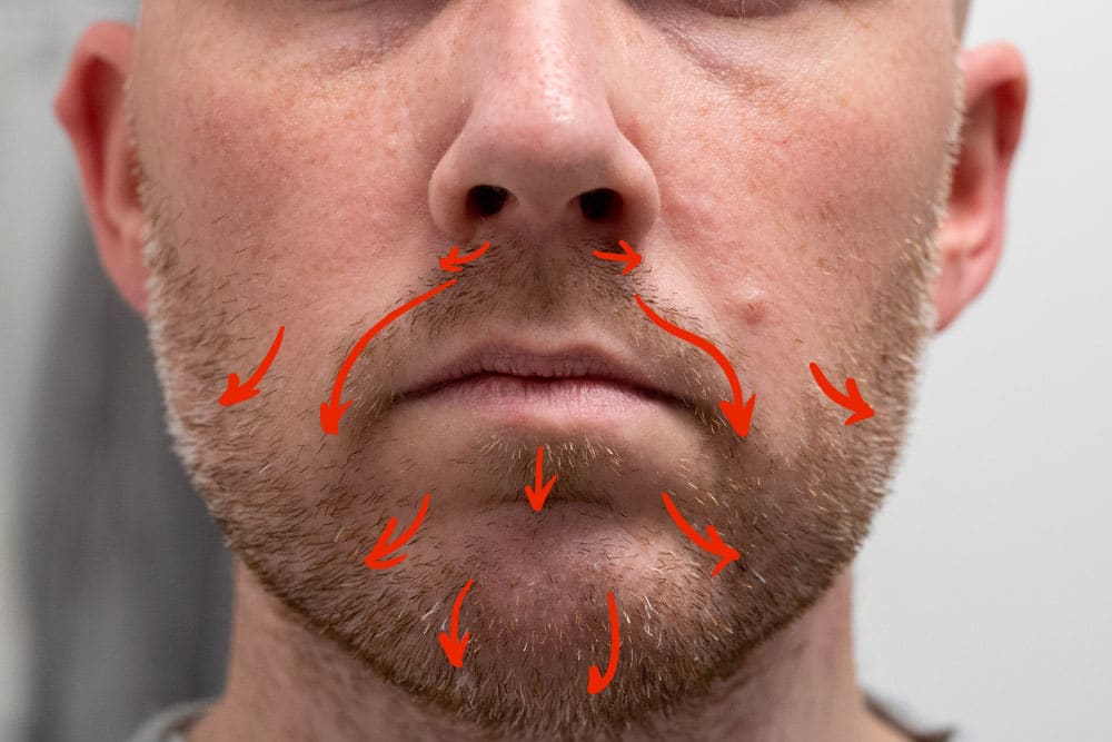 front view of mans beard with red arrows indicating facial hair grain direction