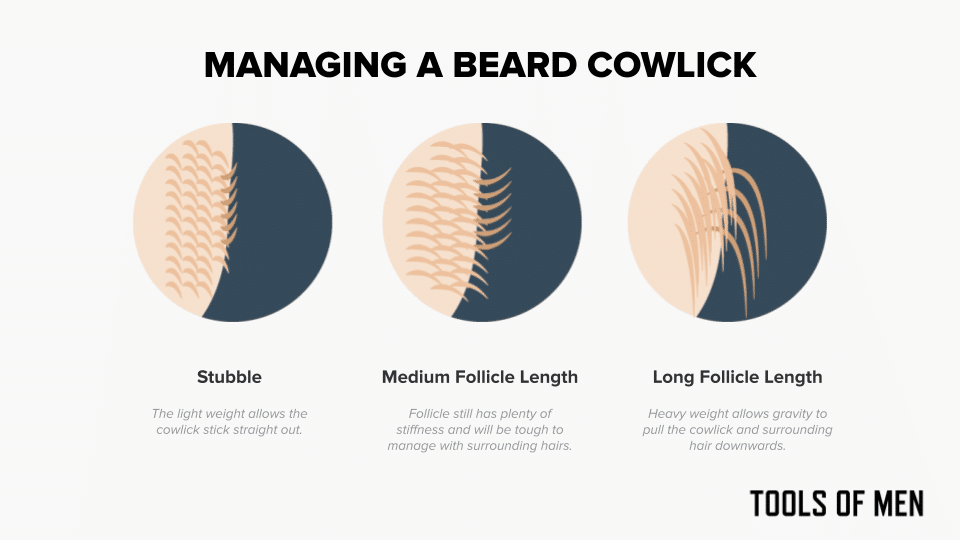 illustration showing how beard cowlicks can be managed