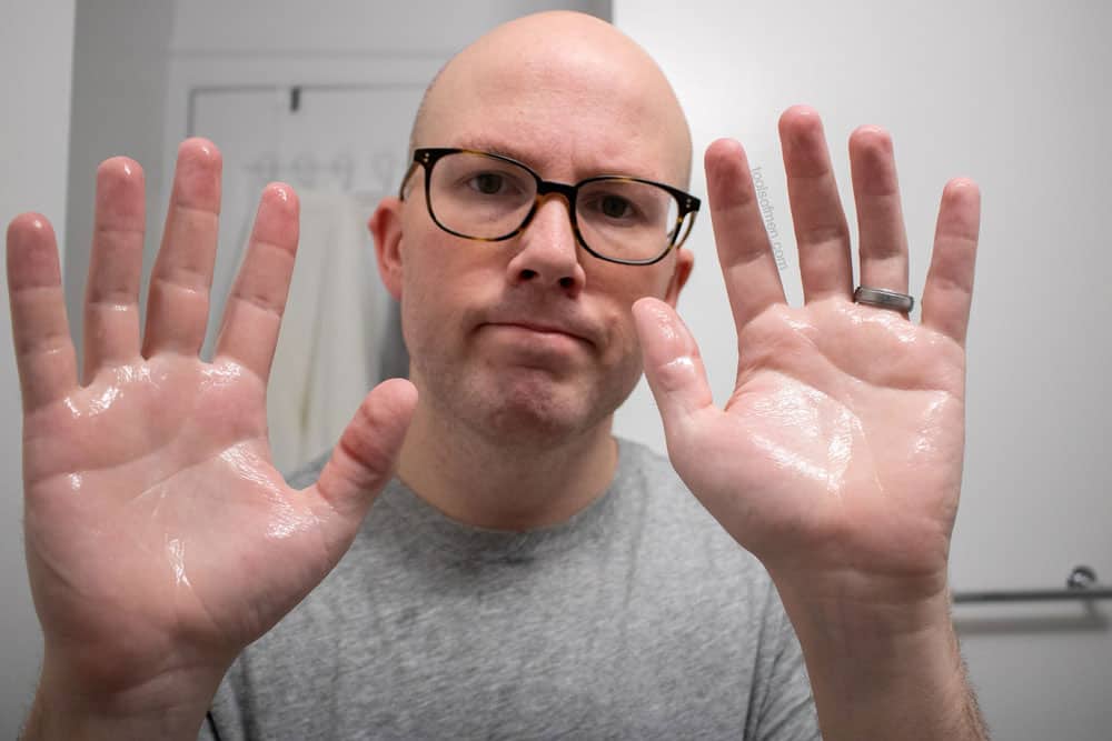 man holding up both hands with balm applied