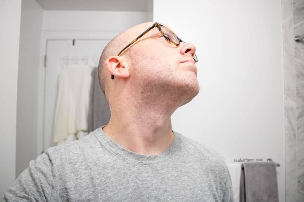 man looking up with neck exposed to demonstrate results of the microtouch solo