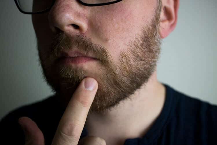 man pointing to a bald spot in his beard