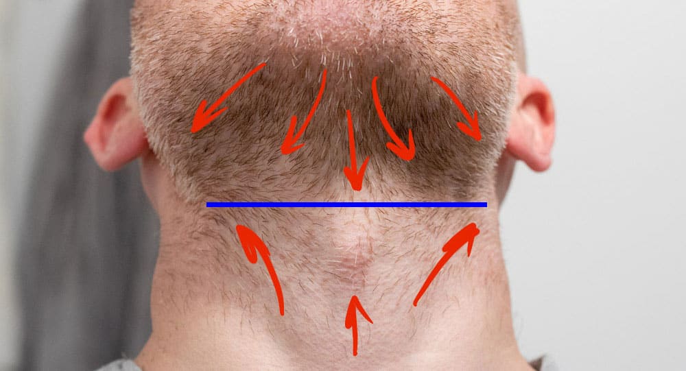 mans neck with red arrows showing growth direction and blue line indicating adams apple