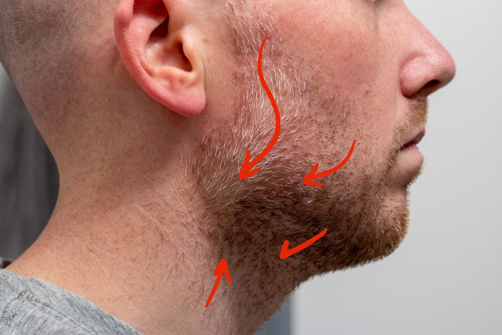 opposite side view of mans beard with red arrows demonstrating grain direction