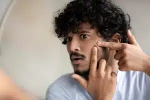 man with worried look popping a pimple