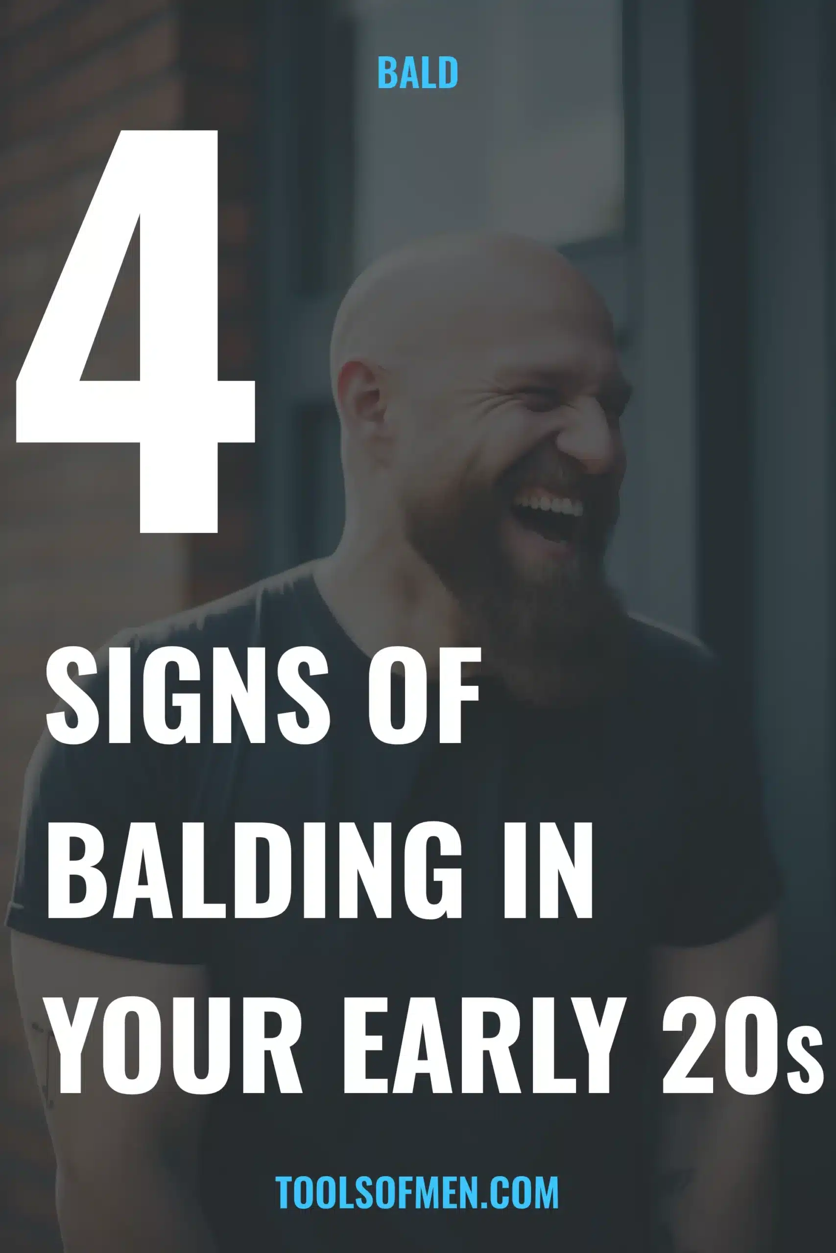 signs of balding pinterest image scaled